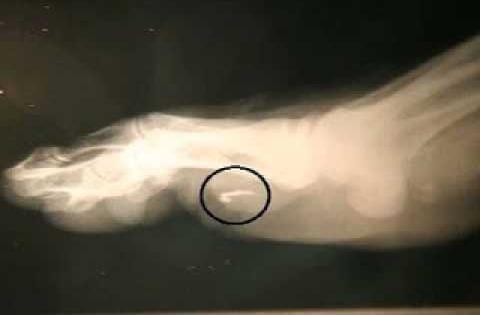 Случаи похищения людей НЛО